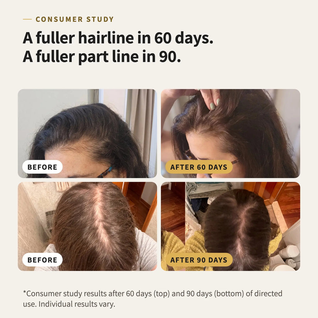 KYIR Fuller Active Hair Serum — product image 2