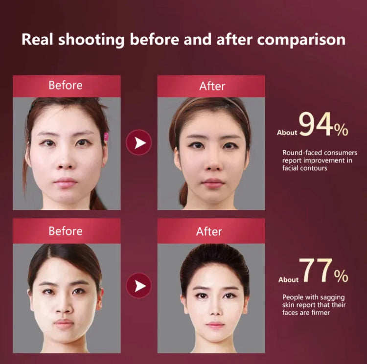 Facial LED Vibration Massager